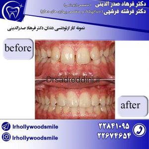 ارتودنسی دندان 1