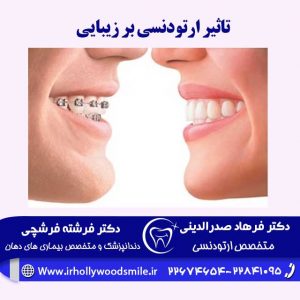 ارتودنسی دندان